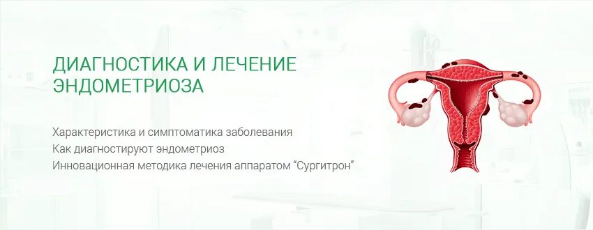 Народные лечения эндометриоза у женщин. Эндометриоз гинекология. Симптомы при эндометриозе. Женское заболевание эндометриоз.