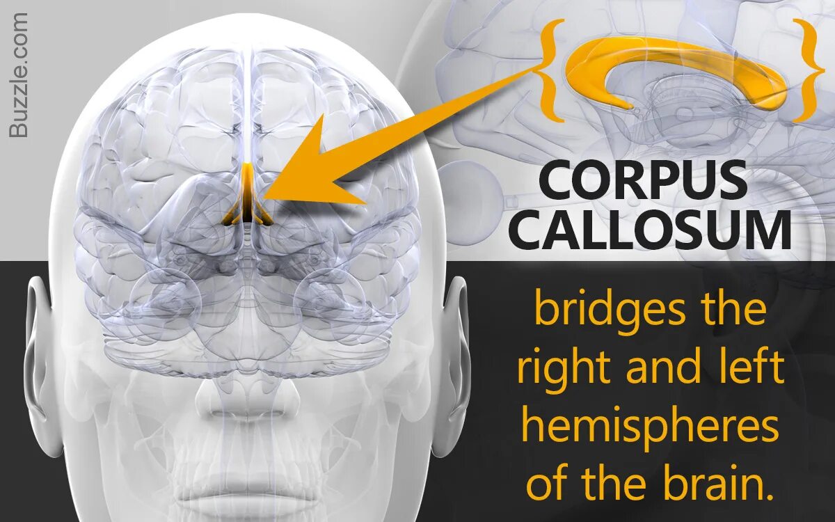 Split brain. Corpus callosum. Мозг Corpus издательства Corpus. Corpus callosum 3d.