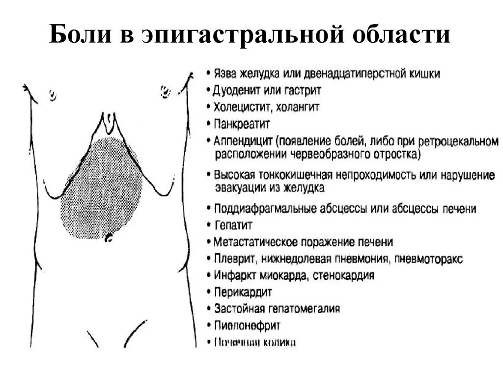 Эпигастральные симптомы
