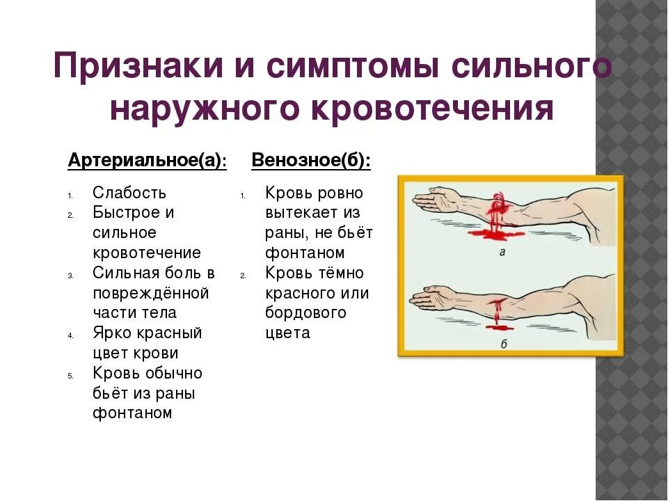 Кровотечение какие симптомы. Характерные признаки наружного кровотечения. Каковы признаки артерии кровотечения. Характеристика артериального наружного кровотечения. Артериальное венозное и капиллярное кровотечение.