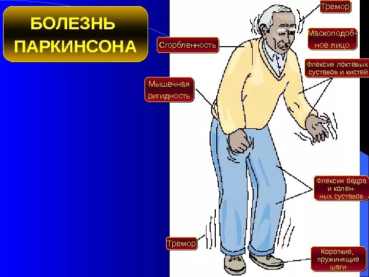 Болезнь паркинсона борьба. Паркинсонизм и болезнь Паркинсона симптомы. Симптомы Паркинсона тремор. Болезнь Паркинсона тремор рук. Синдромы при болезни Паркинсона неврологические.