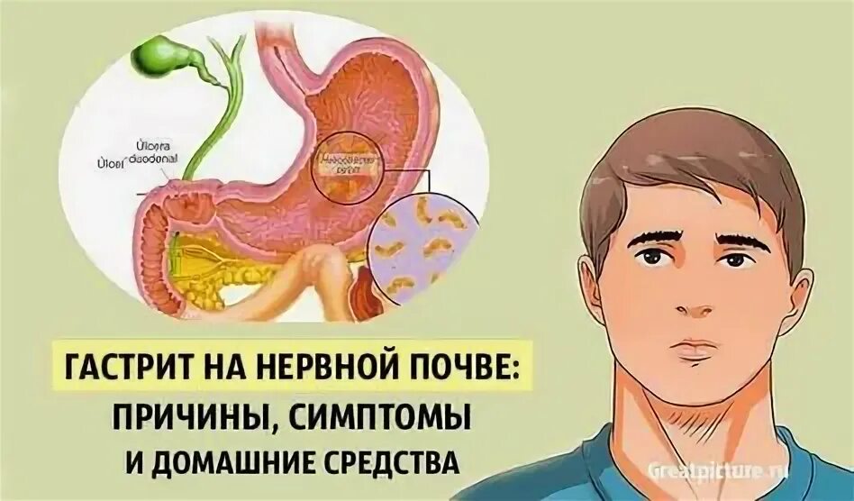 На нервной почве болит симптомы. Обострение гастрита симптомы.