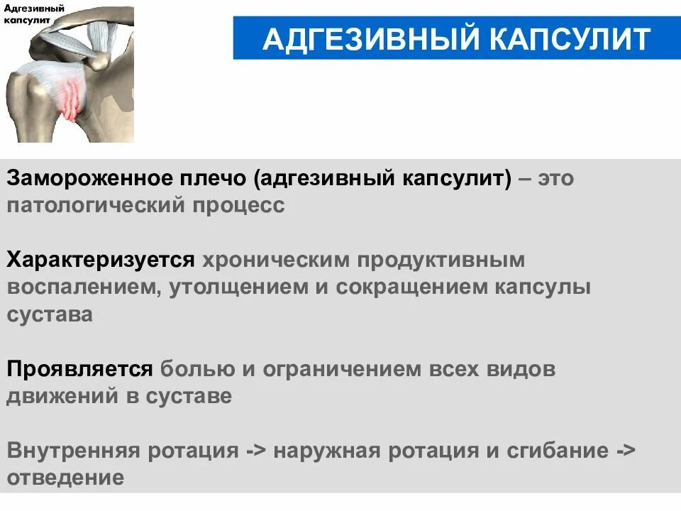 Адгезивный капсулит плечевого сустава. Капсулит замороженное плечо. Адгезивный капсулит мрт.