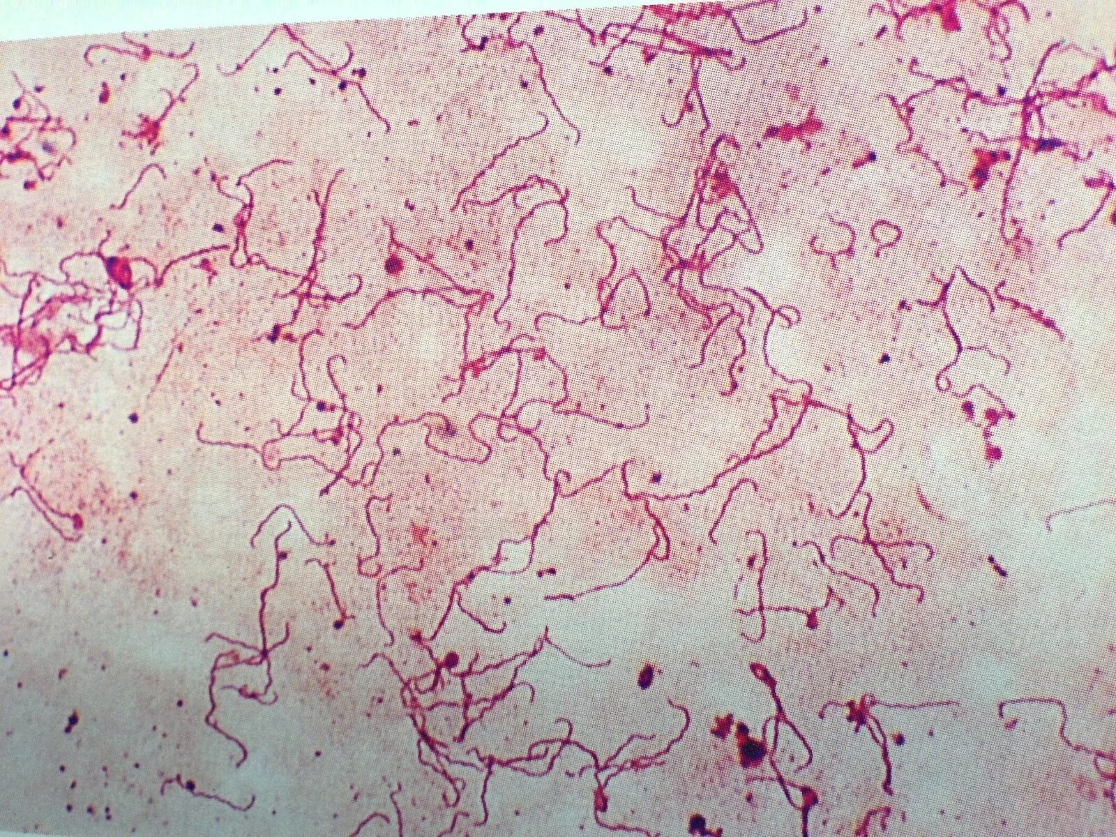 Бледная трепонема treponema pallidum. Бледная трепонема микропрепарат. Трепонема паллидум микроскопия.