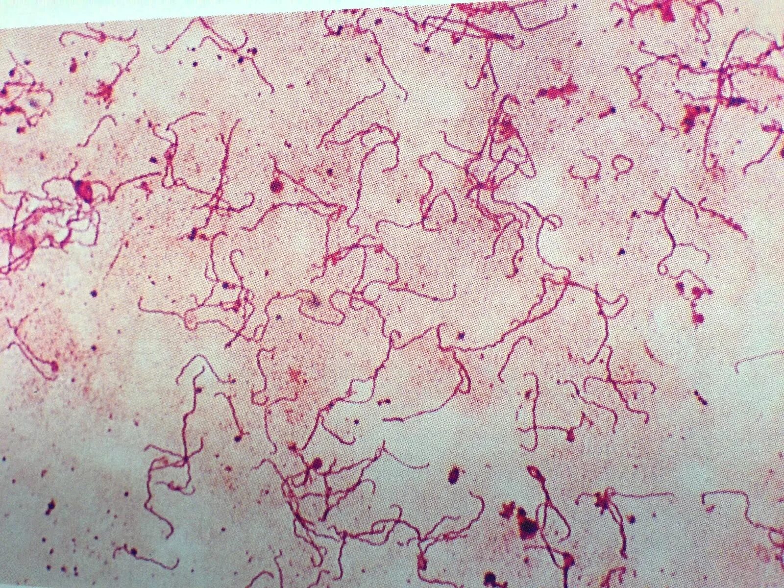 Бледная трепонема микропрепарат. Трепонема паллидум микроскопия.