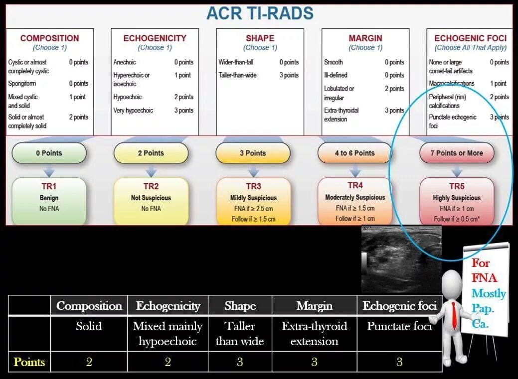 Шкала Tirads. Ti rads 3 УЗИ. Калькулятор тирадс. Tirads классификация. Шкала rads