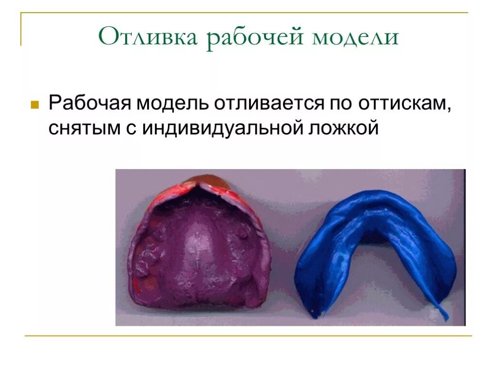 Оттиска индивидуальной ложкой. Слепок индивидуальной ложкой. снятие оттиска индивидуальной ложкой. снятие слепков индивидуальной ложкой. оттиск на индивидуальной ложке.