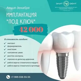 Имплантация под ключ в москве недорого
