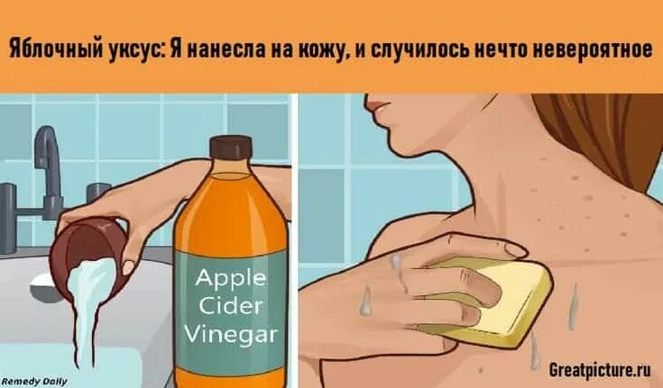 Что будет если уксус попадет в глаза. Отравление яблочным уксусом. компресс с яблочным уксусом.