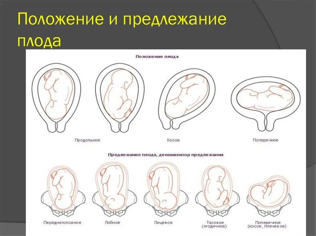 В каком положении находится ребенок