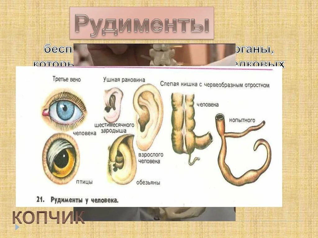 Аппендикс является рудиментом. Рудименты у животных примеры.