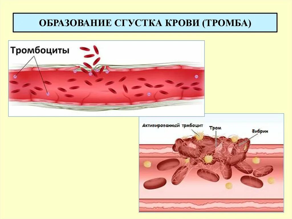 Кровь ниткой