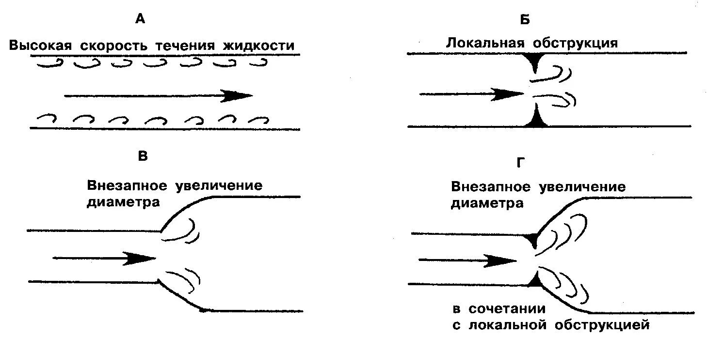 Турбулентность сердечного ритма. Турбулентный воздушный поток. турбулентность в жидкости. локальная скорость жидкости. турбулентность сосудов.