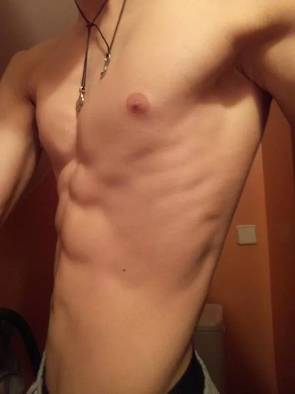 Выпирание ребра с левой стороны. Выпирание ребра с левой стороны. Выступающее ребро. Выпуклая грудная клетка. Припухлость под левым ребром.