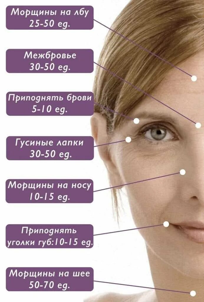Как колоть ботокс. Точки введения диспорта схема. точки для введения ботокса в межбровье. мимические морщины. схема введения ботокса.