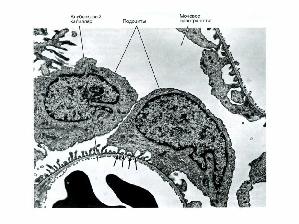 Цитотрабекулы. Подоциты. Функция подоцитов почки. Подоциты. Строение гломерулярной базальной мембраны.