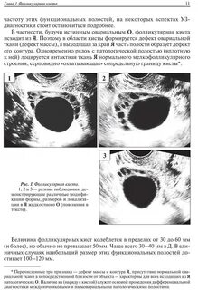 Фолликулярная киста яичника что делать
