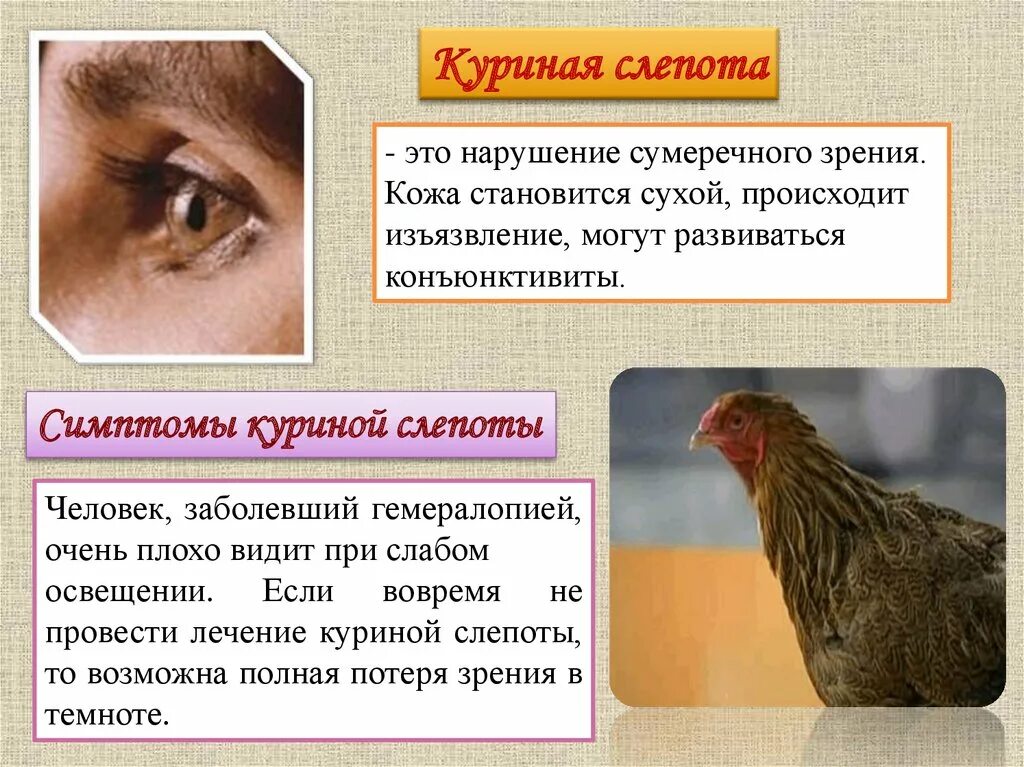 Заболевание куриная слепота витамины. Куриная слепота болезнь. Гемералопия (куриная слепота). Куриная слепота — расстройство сумеречного зрения..