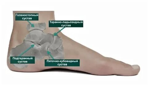 Полость в ноге