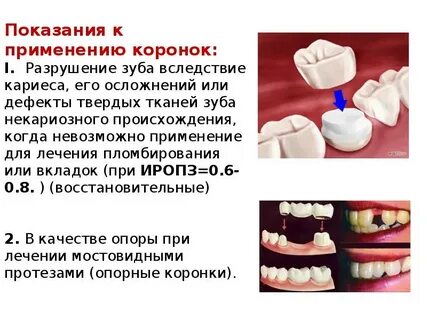 Дефекты коронки