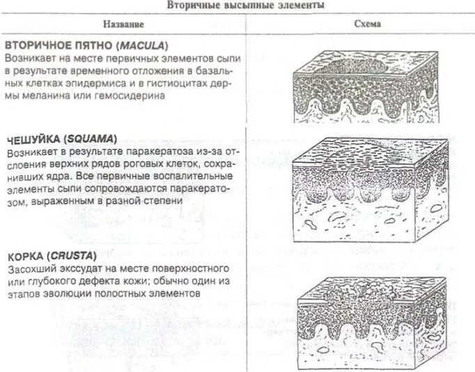 Вторичные элементы поражения