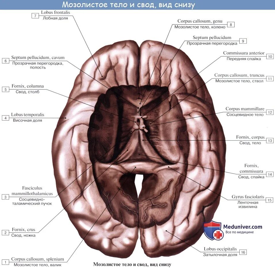 Спайки головного мозга. Мозолистое тело свод анатомия. Мозолистое тело и свод мозга. Свод мозга анатомия. Лобные доли мозга мозолистое тело.