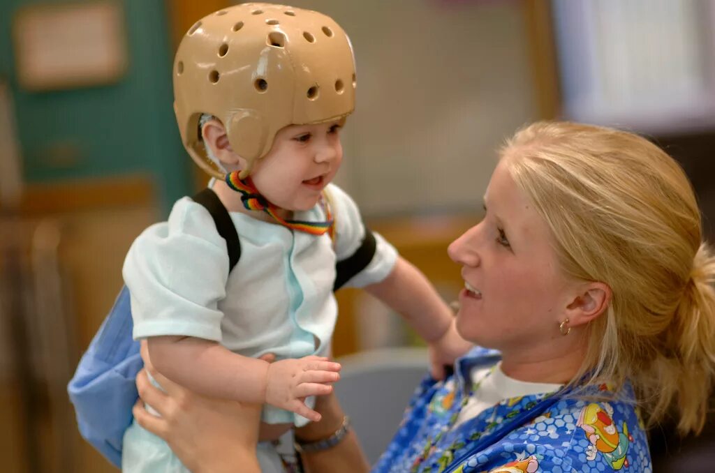 Детская эпилепсия раннего возраста. Дети больные эпилепсией. Шлем для детей с эпилепсией.