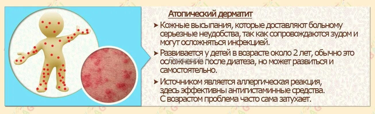 Как выглядит золотистый стафилококк на коже Картинки STAPHYLOCOCCUS AUREUS СТЕПЕНИ