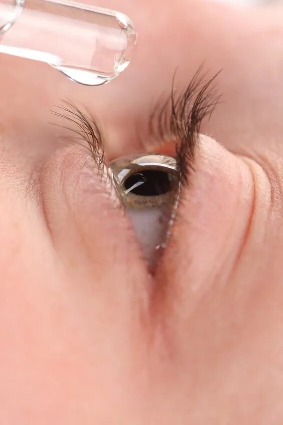 Как выглядит бельмо на глазу у человека Blindness reversed in living mammals through new technique which could treat tot