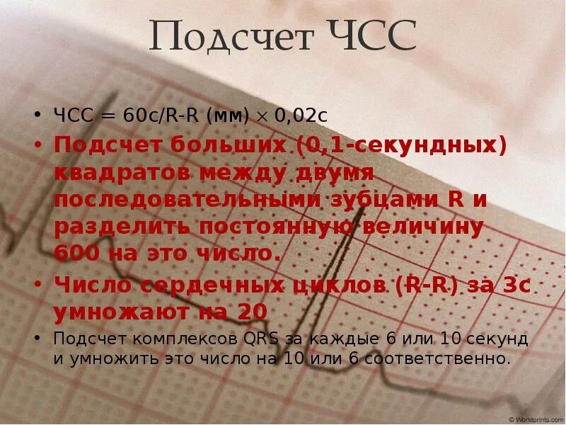Подсчет числа сердечных сокращений. Подсчет чсс. как подсчитать чсс. подсчёт чсс по экг по квадратам.
