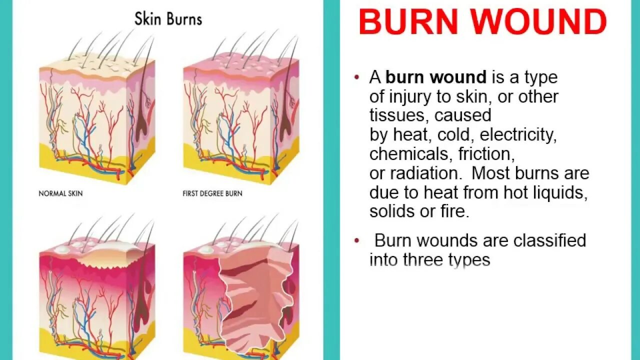 What is a wound. What is a wound