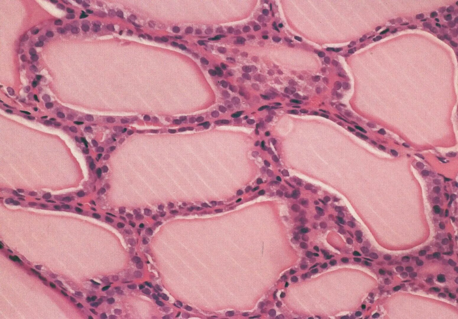 Срез щитовидной железы. Парафолликулярные клетки щитовидной железы гистология. Клетки щитовидной железы гистология. Фолликулы щитовидной железы гистология. Щитовидная железа гистология.
