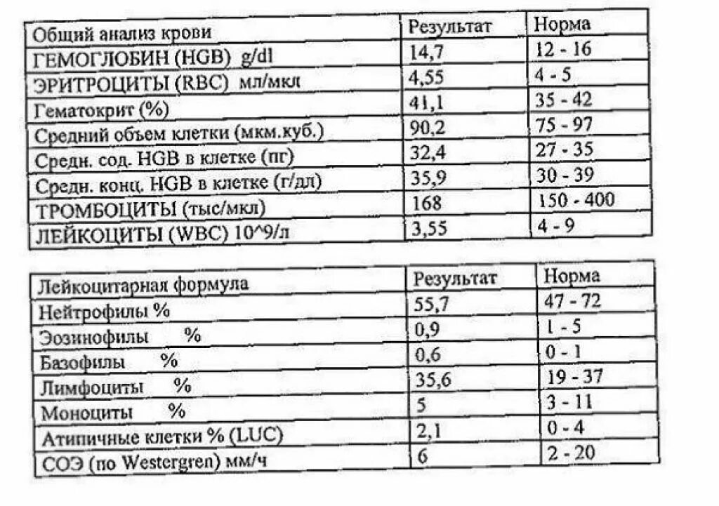 Высокое содержание в крови. Обозначение общего анализа крови расшифровка таблица. Общий клинический анализ крови развернутый расшифровка норма. Развернутый клинический анализ крови таблица. Анализ крови расшифровка гемоглобин норма.