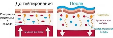 Как работают тейпы