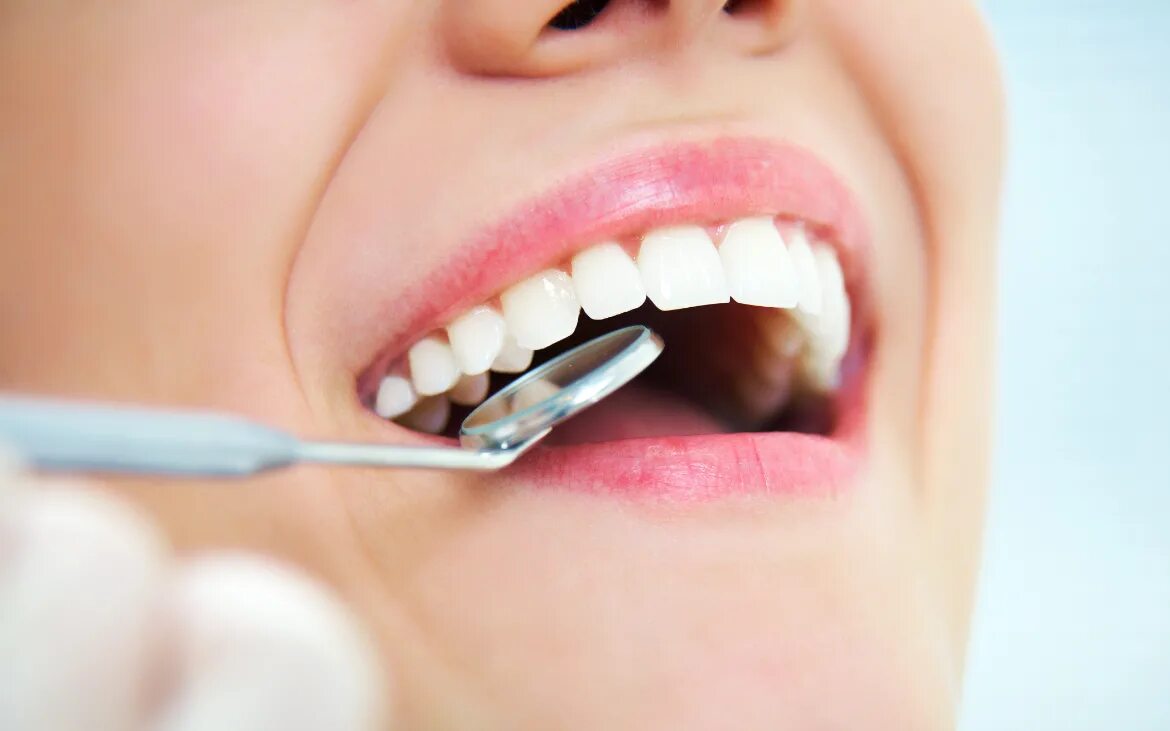 Профессиональная гигиена полости рта. Какие лечить зубы. Зубы стоматолог. Сайт стоматологии. Стоматология зубы больные.