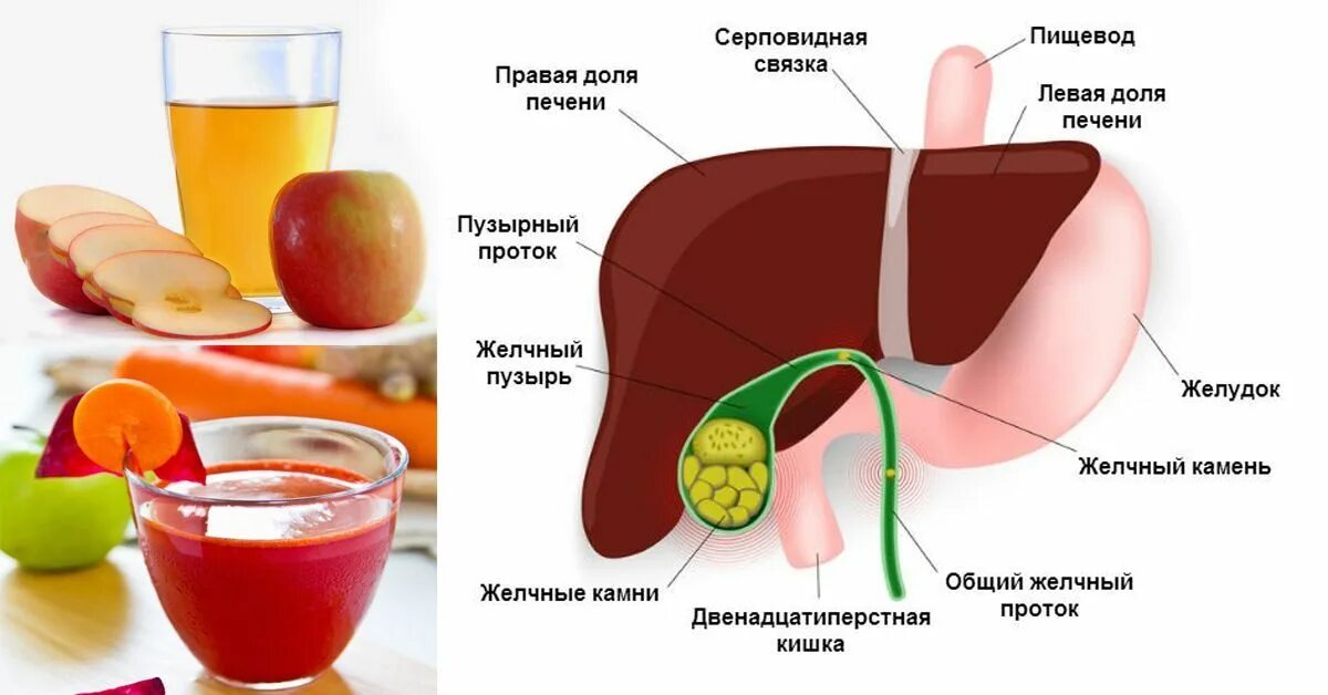 Польза для печени и желчного. Диета для желчного. Печень и желчный. Камни в жёлчном пузыре может ли болеть печень.