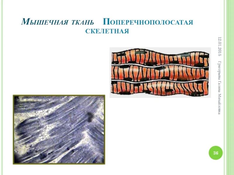 Волокна поперечно полосатой мышечной ткани ядра. Поперечно Скелетная мышечная ткань. Поперечная полосатая Скелетная мышечная ткань. Поперечно-полосатая исчерчение мышечной ткани. Исчерченная Скелетная мышечная ткань.