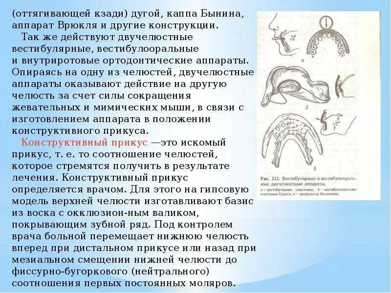 Ортогнатическая операция мезиальный. Дистальный прикус внчс. Остеотомия челюсти операция. Ортогнатическая операция дистальный прикус. Челюсть кзади.