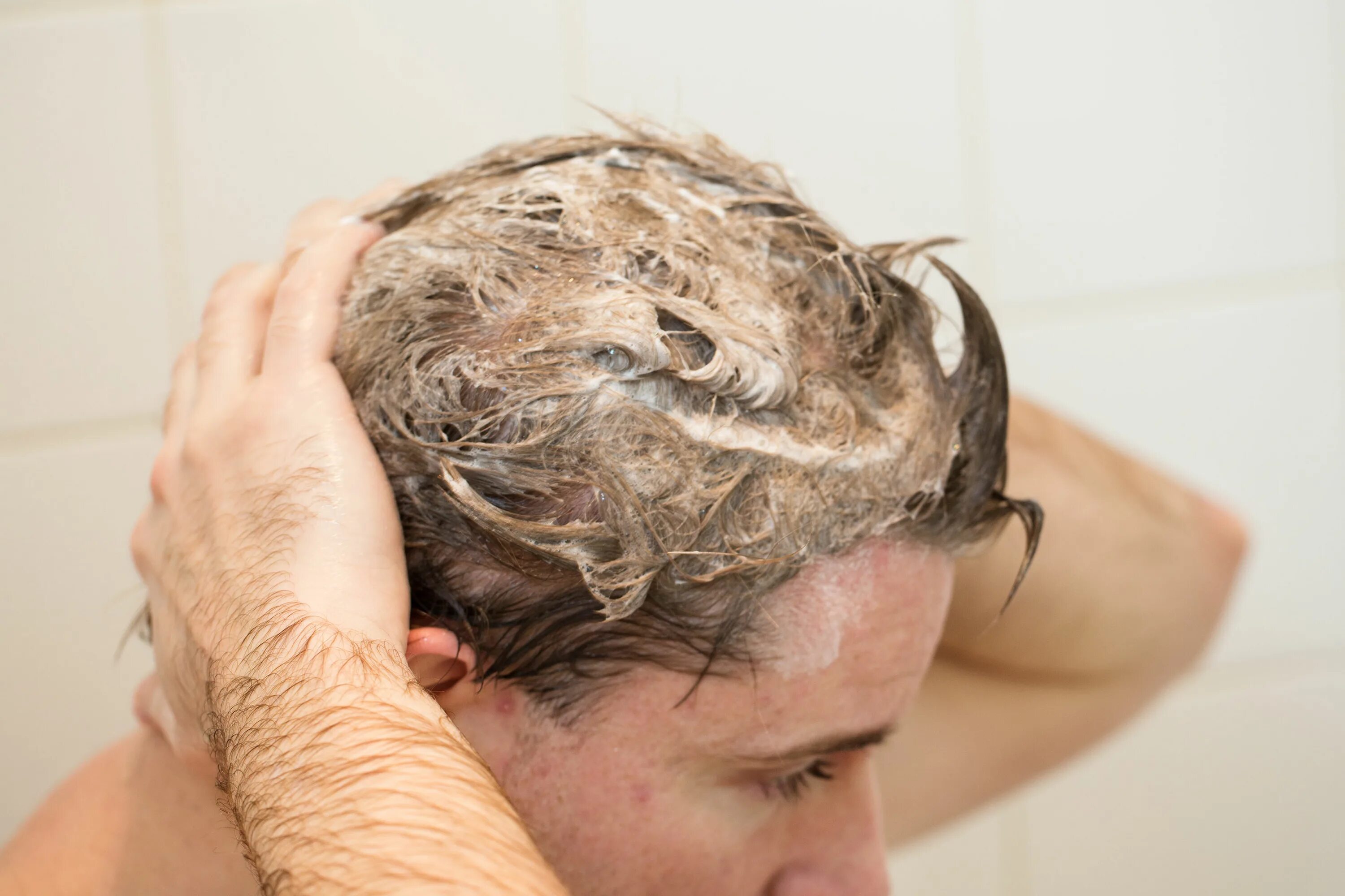 Скальп кожи головы. Фолликулит фолликулит. Грибок malassezia кожи головы. Скальп кожи головы. Микропигментирование волос на голове.