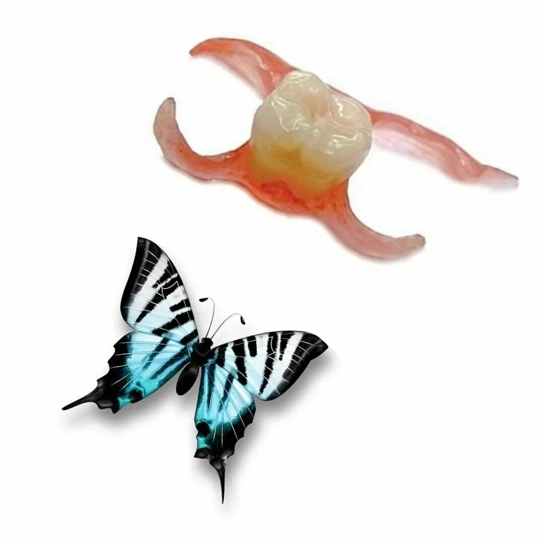 Съемный протез зуба бабочка. Иммедиат протез бабочка. Микропротез бабочка/ иммедиат-протез. Съемный микропротез «бабочка».