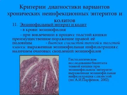 Энтерит у детей