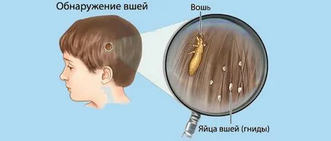 Откуда берется голова