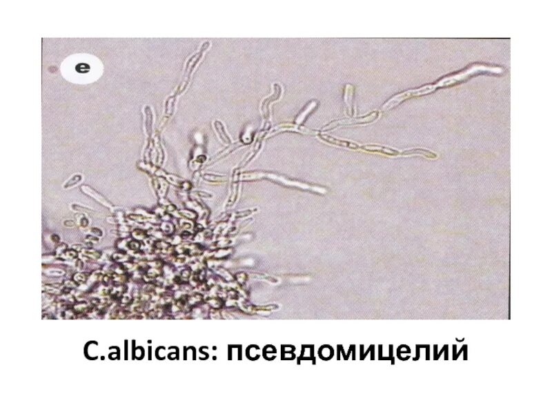 Псевдомицелий кандида. Псевдомицелий гриба рода Candida. Грибы кандида микроскопия. Нити мицелия микроскопия. Мицелий грибов на коже