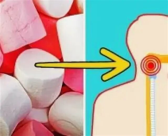 Кость от рыбы застряла в пищеводе. Рыбья кость в горле снимок. Рыбная косточка в горле. Застряла косточка от рыбы в горле. Собака проглотила кость.