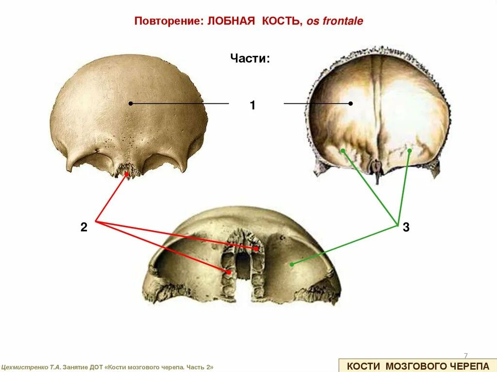 Кости мозгового черепа строение. Мозговой отдел черепа лобная кость. Кости мозгового черепа анатомия лобная кость. Анатомия лобной кости черепа. Кости мозгового черепа: лобная, затылочная, теменная..