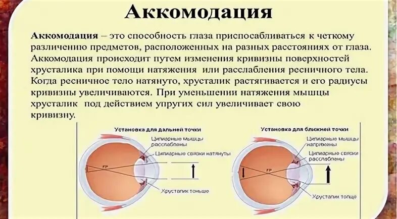 Нарушение аккомодации что это такое