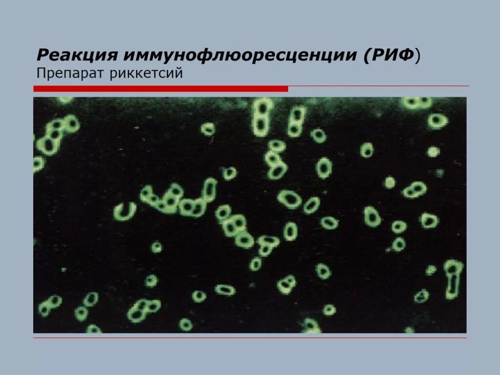 Риф реакция. Реакции непрямой иммунофлюоресценции (риф). риф реакция иммунофлюоресценции. реакция непрямой иммунофлюоресценции рниф. реакция иммунофлуоресценции микробиология.