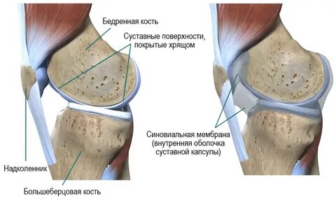 Выпот коленного сустава что это