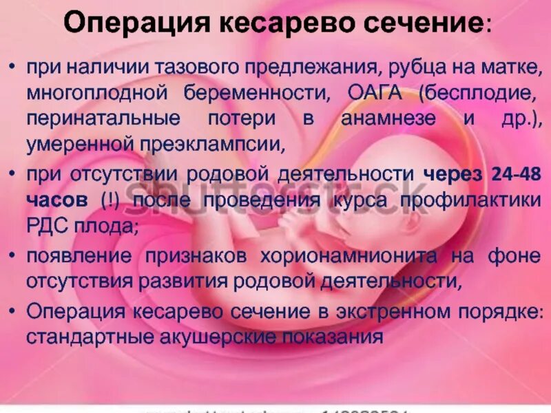 Сколько после кесарево нельзя заниматься. Как проходит кесарево сечение. Кесарево этапы операции. Сколько по времени длится операция кесарева сечения. Кесарево сечение беременности.