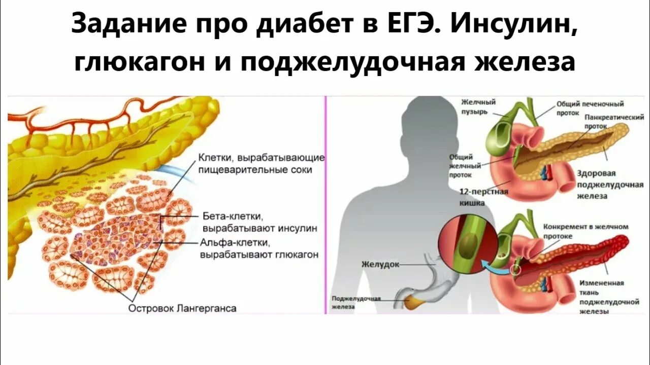 Функции панкреатита. Функции поджелудочной железы СД 1. Панкреатический сахарный диабет. Поджелудочная железа сахарный диабет рисунок. Поджелудочная железа инсулин и глюкагон.